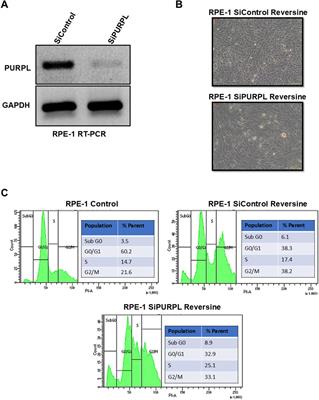 Long noncoding RNA, PURPL is associated with aneuploidy and its magnitude of expression level is dependent on P53 status